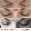 Long4lash eye lash serum | 
سيرم تطويل الرموش الرهيب من لونك فور لاش