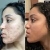 The inkey list tranxamic acid serum | سيرم ترانكزامك اسد  للتفتيح من ذا انكي ليست