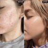 The inkey list Niacinamide 20% | سيرم نياسيناميد من ذا انكلي ليست تركيز ٢٠٪